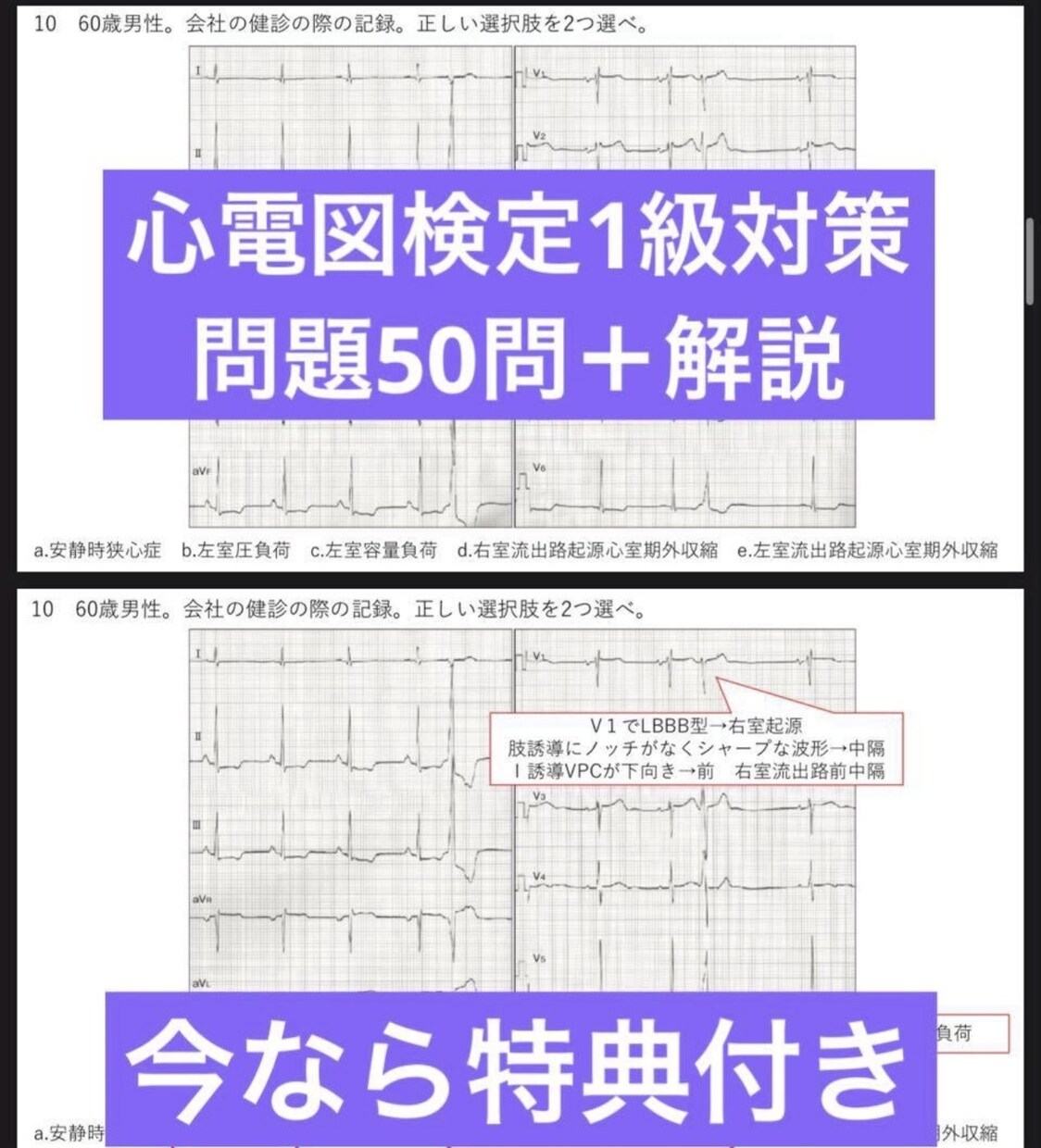 心電図検定1級対策を一緒にします 心電図検定1級を一発取得した看護師がアドバイスします！ イメージ2