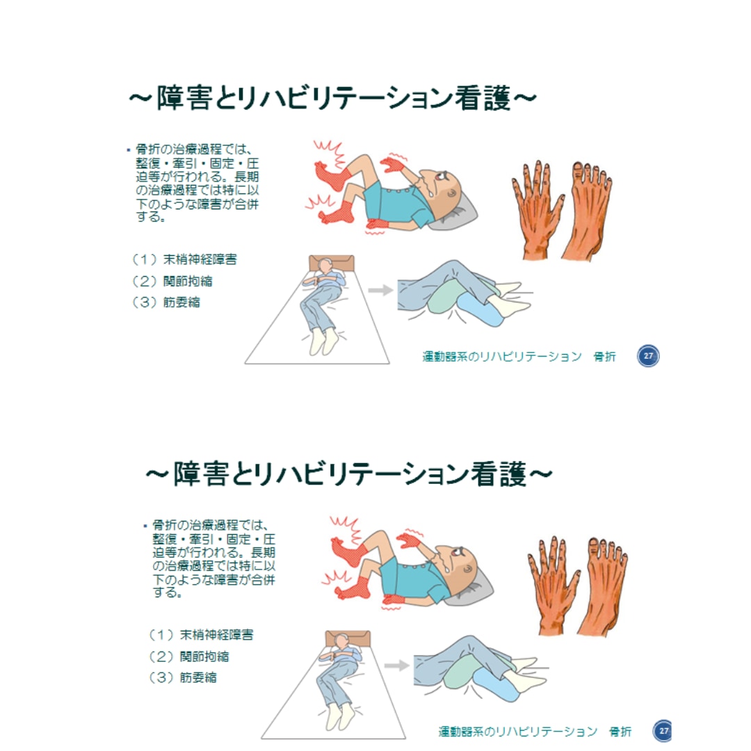 リハ、看護の学生さん！リハビリの？をサポートします 病棟ADLの上げ方、自主訓練、リハビリの？に答えます。 イメージ3