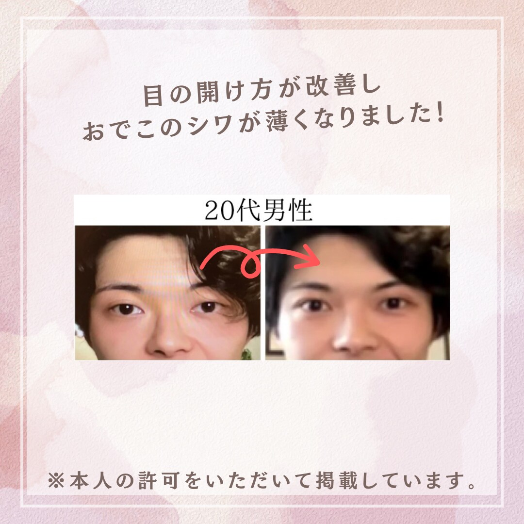 一生使える！セルフ美顔筋エクササイズを教えます 1日5分で若返り！お金をかけずにキレイになれてコスパ◎です！ イメージ6