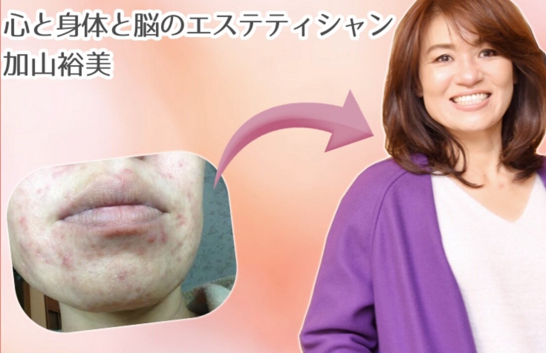 見た目年齢−10歳になる方法を教えます お金をかけずに見た目年齢−10歳を作る土台作り イメージ1