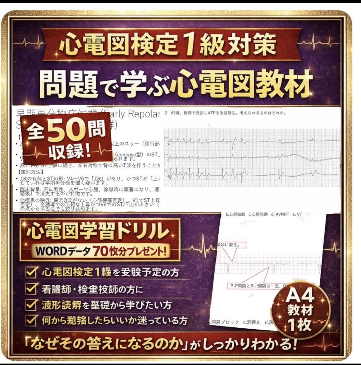 心電図検定1級対策を一緒にします 心電図検定1級を一発取得した看護師がアドバイスします！ イメージ1