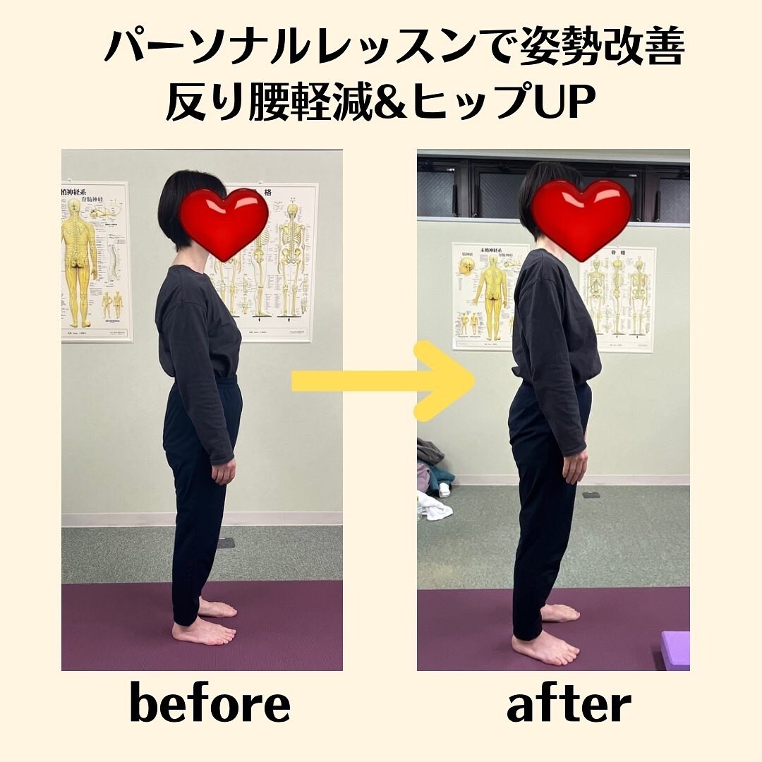 姿勢改善ヨガ&ピラティスを行います 姿勢を良くしたい！動作をうまくしたい！ イメージ1