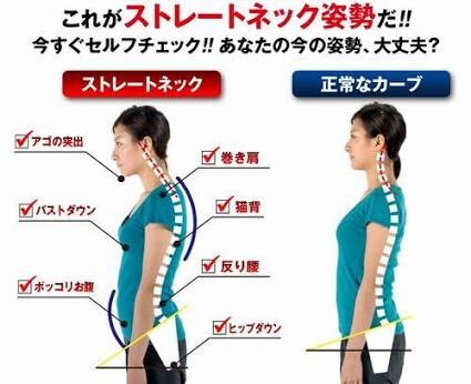 現代人に多いストレートネック改善法教えます 〜肩こり、腰痛、頭痛どれかに当てはまる方必見！！〜 イメージ1