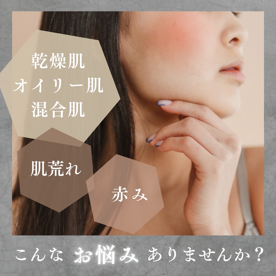 肌荒れ等でお悩みの方にスキンケアアドバイスします エステティシャン歴15年以上のプロがアドバイス致します イメージ2
