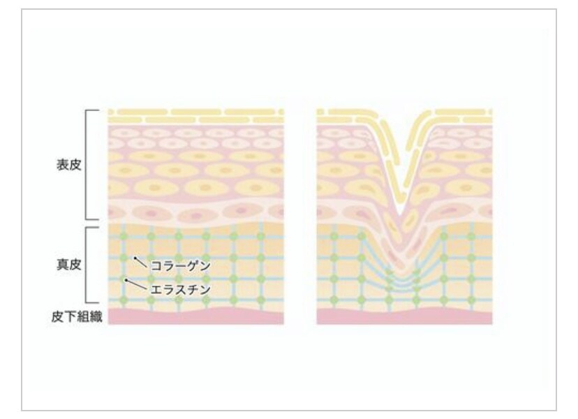 スキンケアの見直し・お肌トラブルの相談乗ります 元美容部員が全力で応援します。追加料金ナシ イメージ2
