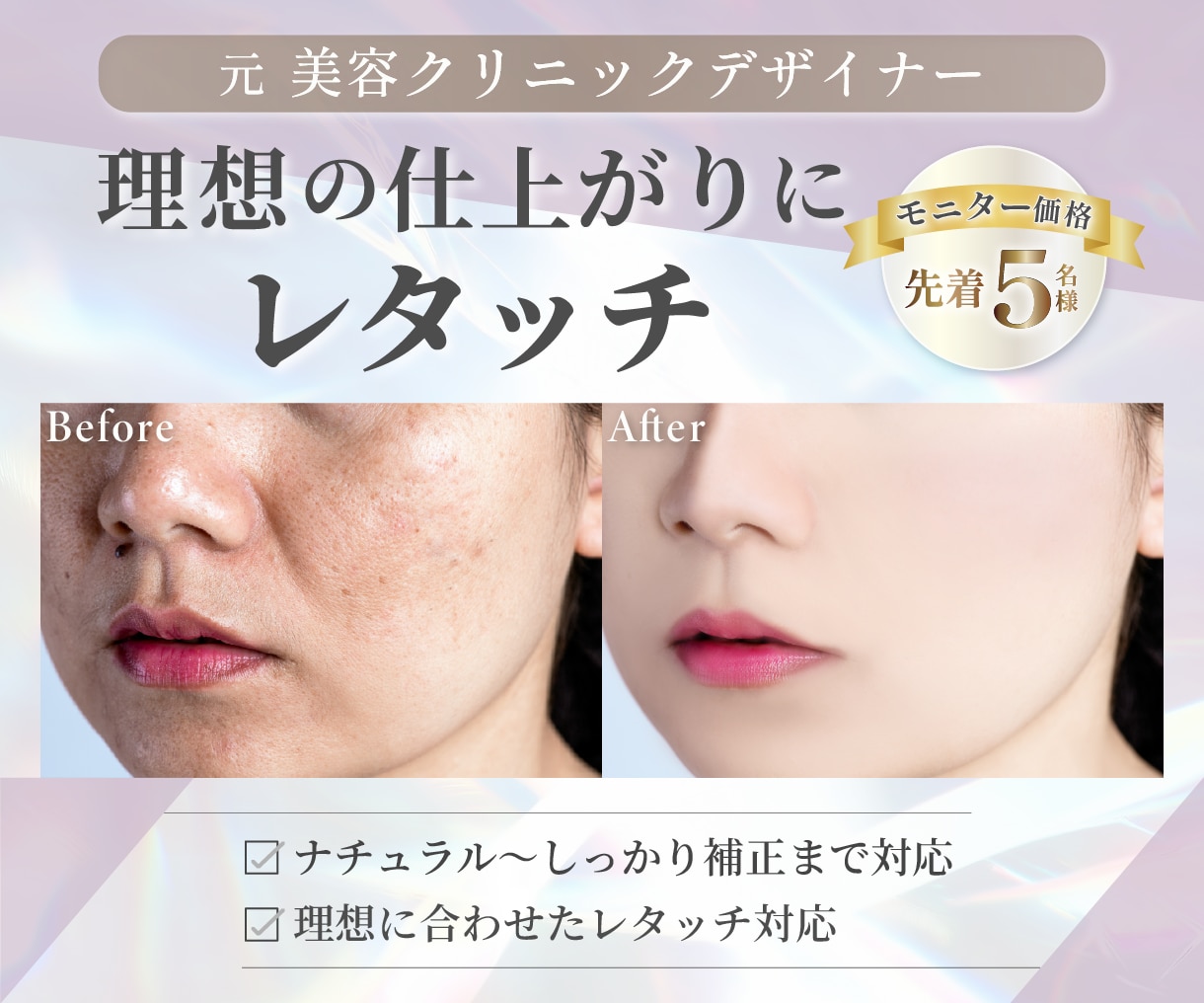 美容クリニック経験者｜人物レタッチ承ります ご希望に合わせてナチュラル〜しっかり補正まで対応 イメージ1