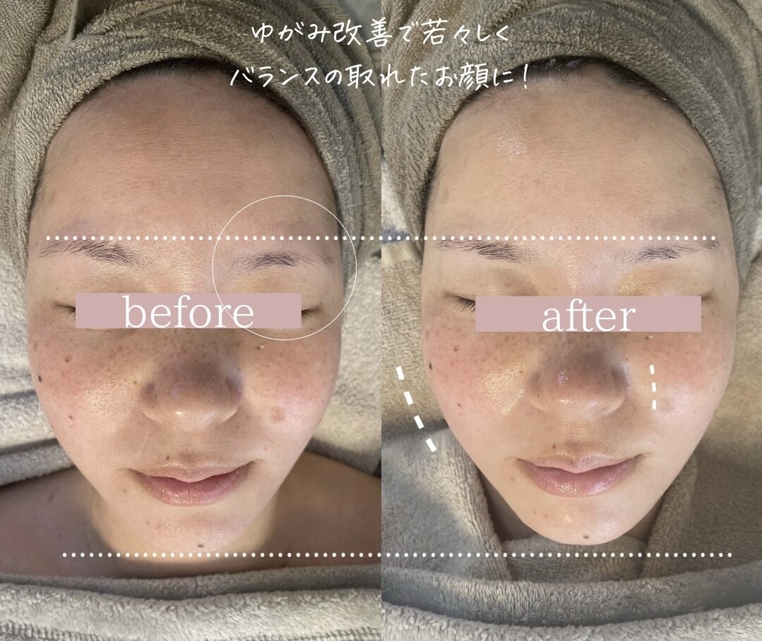 頭蓋骨小顔コルギの技術全て教えます 戻りにくい小顔技術を現役エステティシャンが全て教えます イメージ1