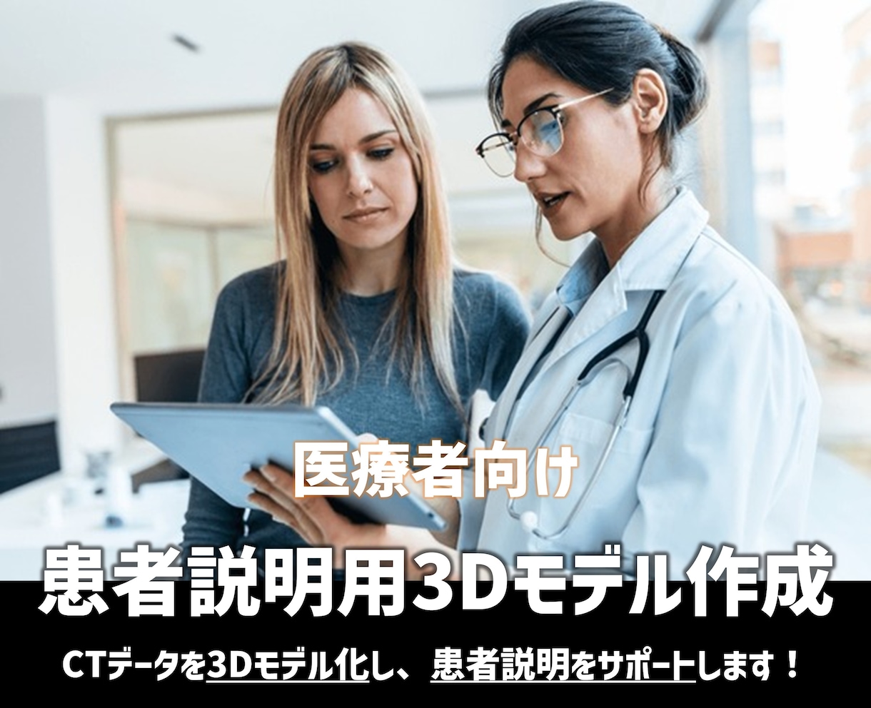 医療者向け｜患者さん説明用の3Dモデルを作成します CT画像を3D化し、患者さんが納得しやすい説明を実現！ イメージ1