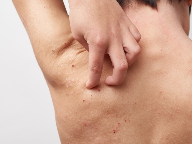 アレルギー克服体験からアトピーの治し方を提供します 薬を使わず、原因は何か。常識を疑い・食生活改善を提案します。 イメージ6