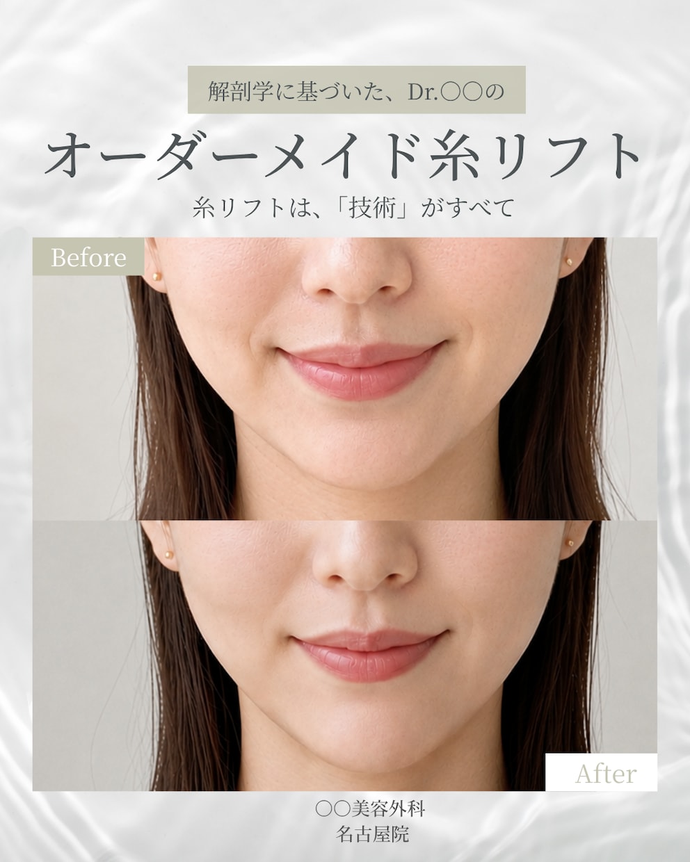 現役看護師>>>美容医療専門インスタ運用代行します SNS運用/集客・採用/アカウント設計/投稿企画・制作/分析 イメージ6