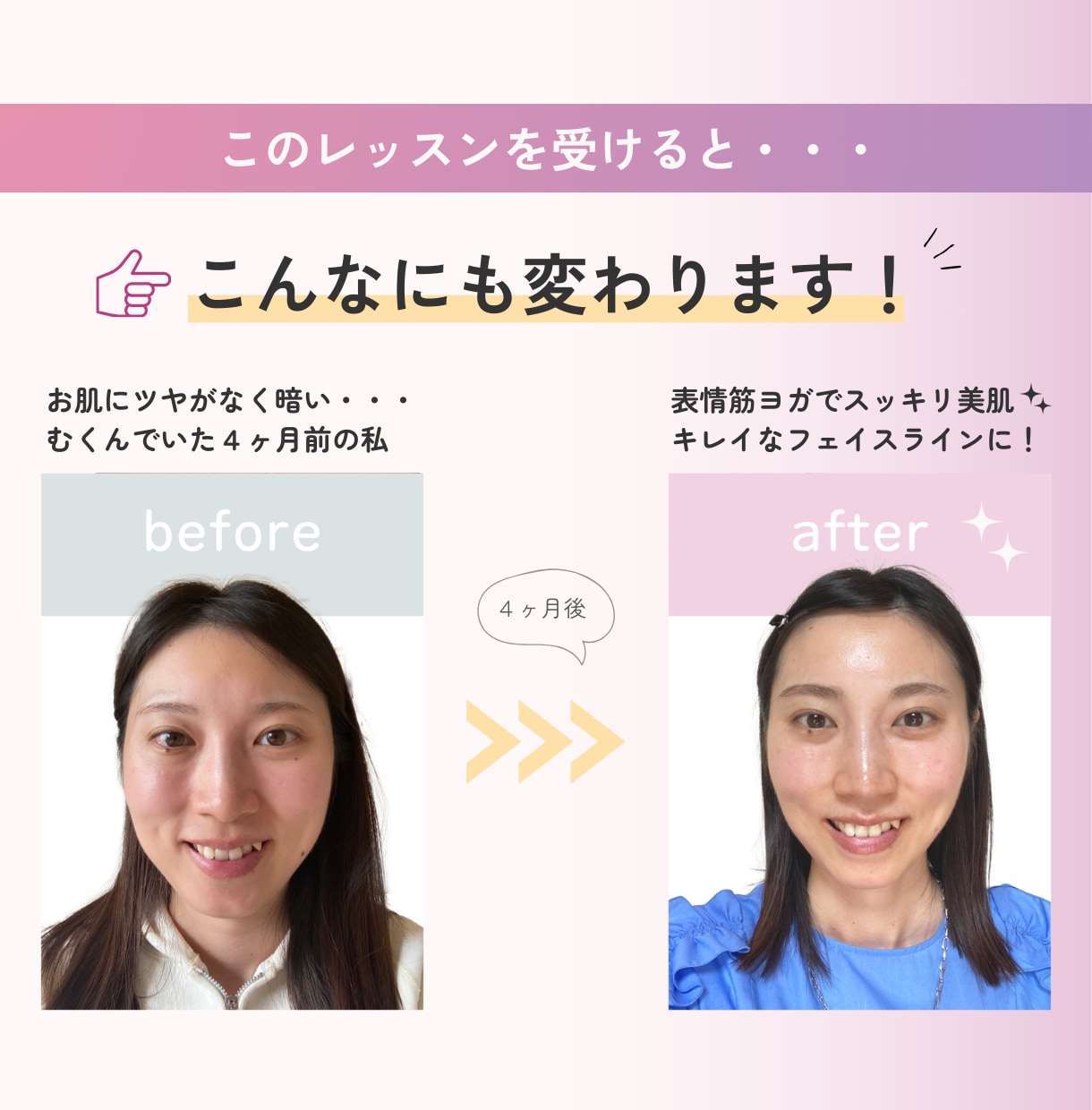 表情筋トレーニングで自然に若返る方法教えます いつまでもきれいでいたいママさん一緒に表情筋ヨガしましょう♡ イメージ2