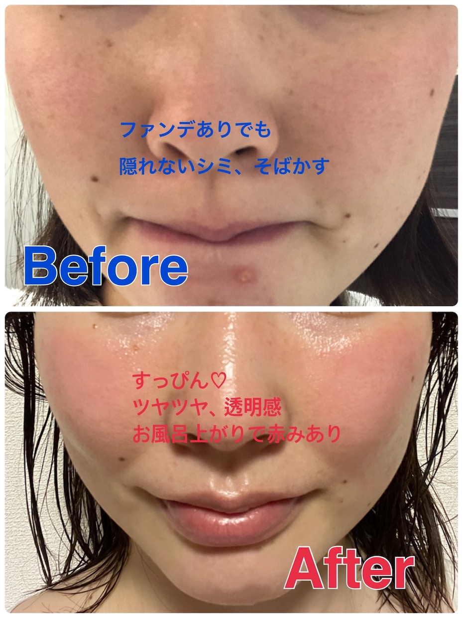 美肌になる方法◇すっぴんに自信がつく秘訣教えます 乾燥、ニキビ、しわたるみ、すべての肌トラブルにおすすめです☆ イメージ3