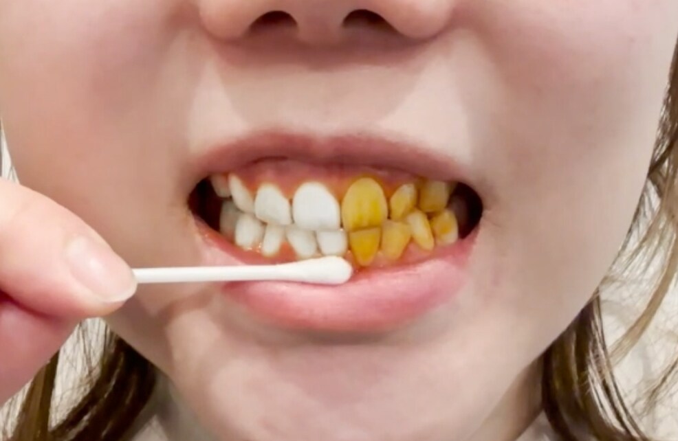 ショート広告動画Befor After加工致します 歯の黄ばみ、顔のシミ、髪の毛の色、全てお任せください イメージ1