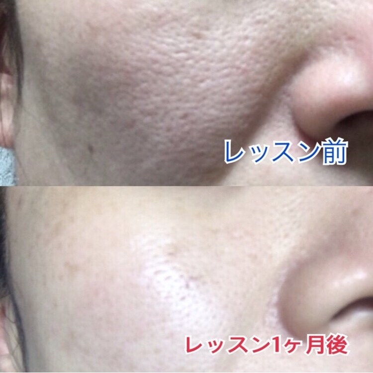 最近の美肌術を教えます あなたの肌に1番適した化粧品、お手入れ方法を教えます！ イメージ3