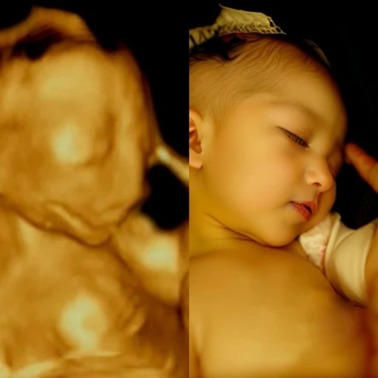 AIでエコー写真から赤ちゃんのお顔を予測します 未来の可愛いお顔を先取り、ワクワクが止まらない イメージ1