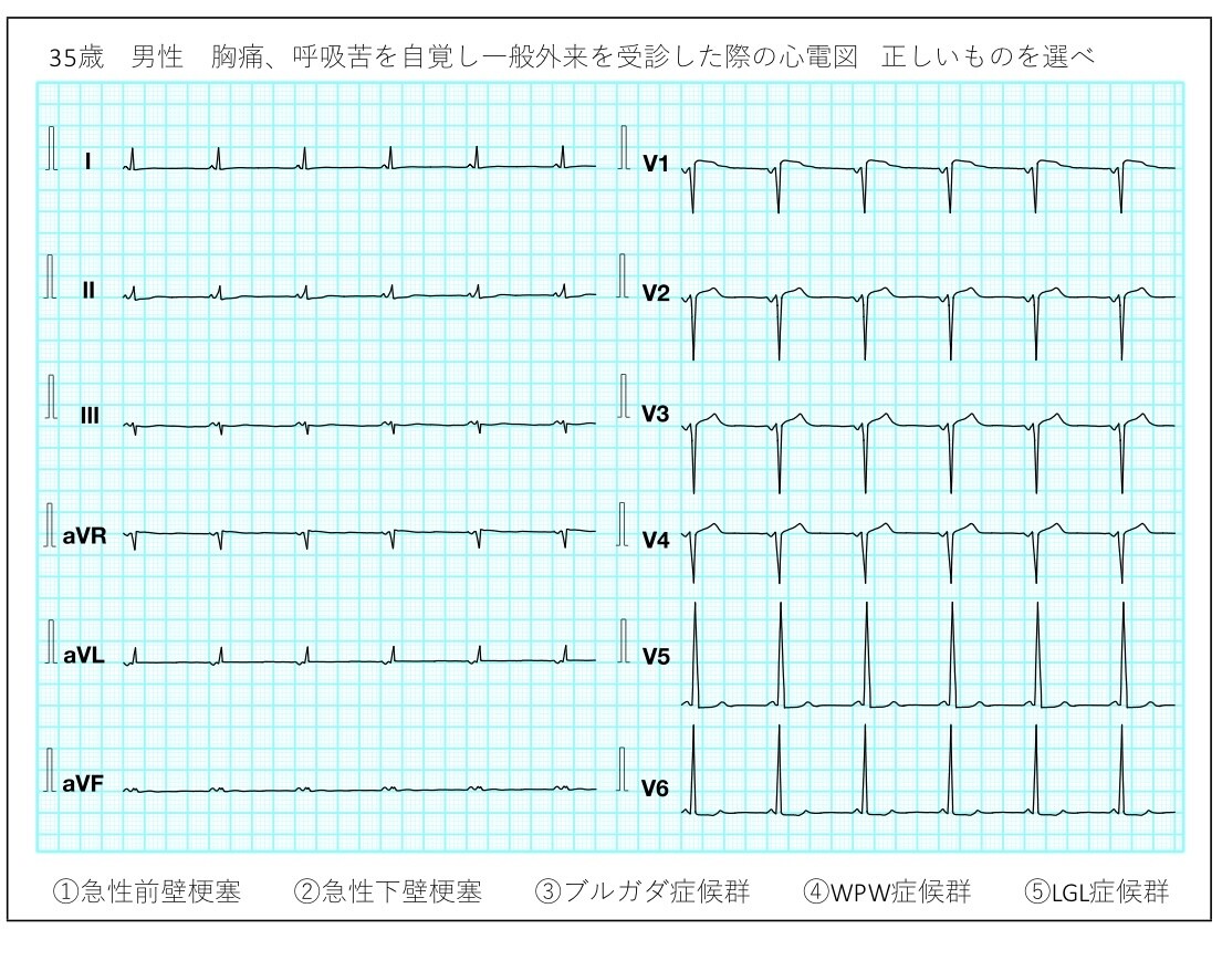 心電図検定対策講座　問題集をお渡します 心電図検定を受験予定の方必見！2-4級レベル解説付き50問！ イメージ2