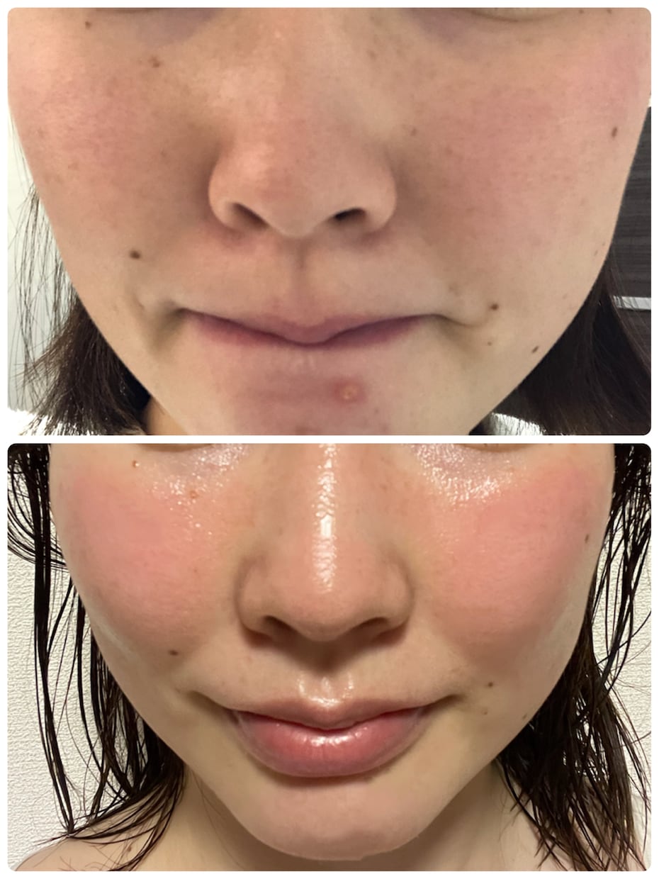 美肌になる方法◇すっぴんに自信がつく秘訣教えます 乾燥、ニキビ、しわたるみ、すべての肌トラブルにおすすめです☆ イメージ4