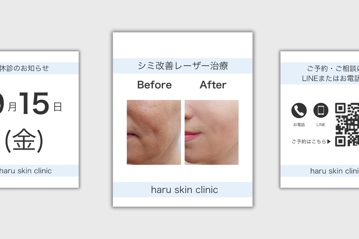 美容クリニック向けSNS投稿デザイン作成します 清潔感のあるデザインで施術紹介・お知らせに最適 イメージ1