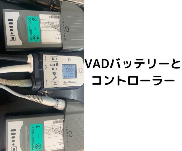 他愛のない雑談OK‼気持のモヤモヤ落ち着かせます 心臓移植待ちの明るい弱者がどんな愚痴でも付き合います イメージ2