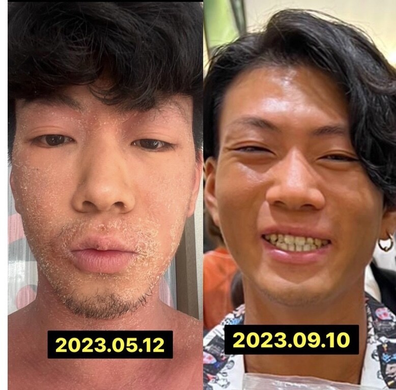 自然治療の指導者が体質のカウンセリング行います ストレスを軽減し減量や体質改善を取り組みたい方。 イメージ5