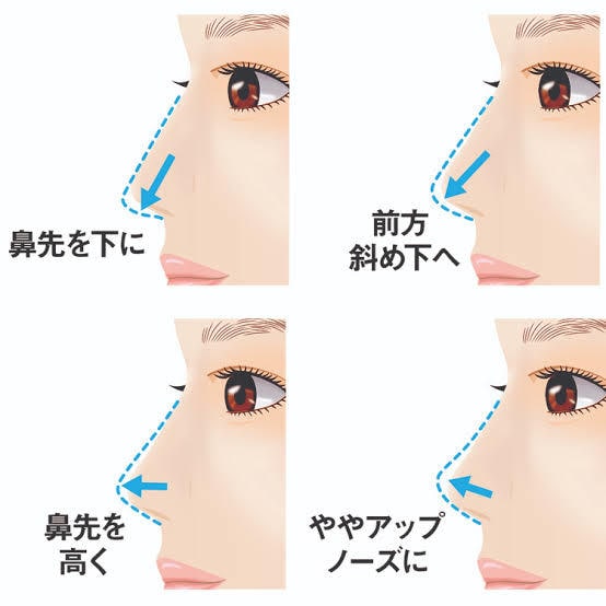 顔写真から必要な美容整形を診断・提案します 元大手美容外科カウンセラーが必要な手術やオペ内容を徹底解説！ イメージ2