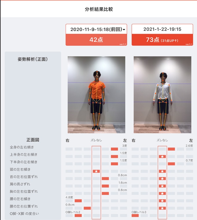 最先端科学に基づくAIによる姿勢診断をします 。2枚の自撮り画像から姿勢を見える化します イメージ3