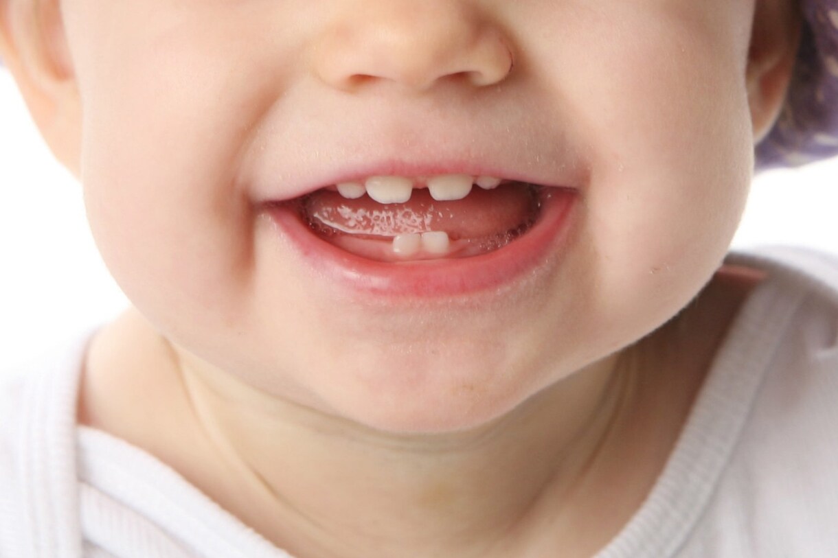 お子様のお口に関する悩みについてご相談にのります ★お子様のお口の中や食事、発達のこと何でもご相談下さい★ イメージ1