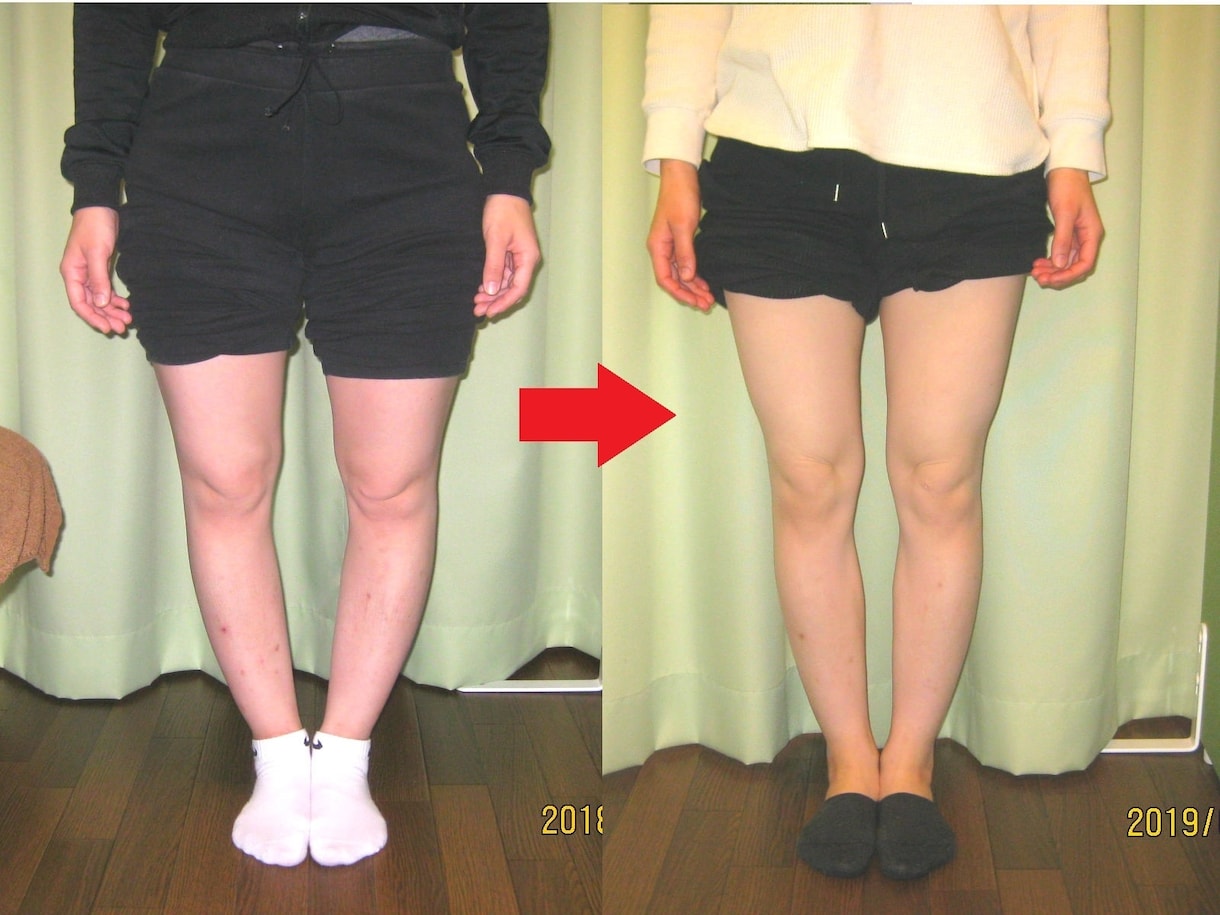１度で完結「楽々おうち de O脚X脚」改善します 歴20年延べ3万件の歪み調整♪現役整体師がO脚改善レクチャー イメージ7