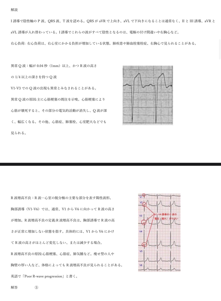 心電図検定1級が心電図検定試験に向け相談に応じます 臨床・試験対策・症例読影まで幅広く対応！ イメージ4