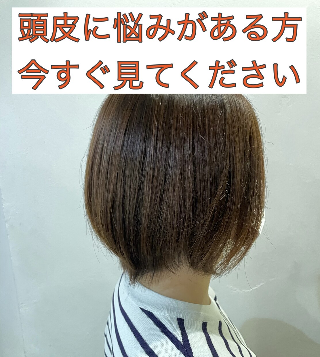 抜け毛、薄毛やボリュームダウンの最適解教えます 5月限定【1万円OFF】2名様のみ イメージ1