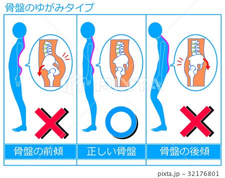 プロの治療家があなたの姿勢改善を教えます 今痛いのはどこ？腰や首肩？それって姿勢が原因かも！ イメージ1