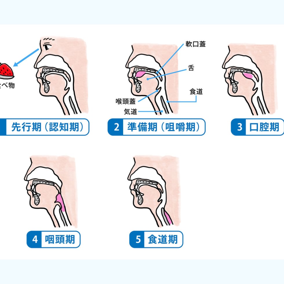 言語聴覚士が食事のお悩み解決します 10年目STが嚥下リハで実際提供した知識を共有 イメージ6