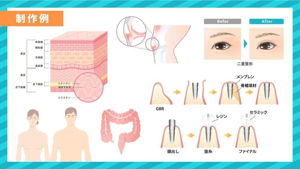 分かりやすい！伝わる！図解・解説イラスト制作します 整形外科・歯科・美容外科様など様々な図解イラストを作成 イメージ3