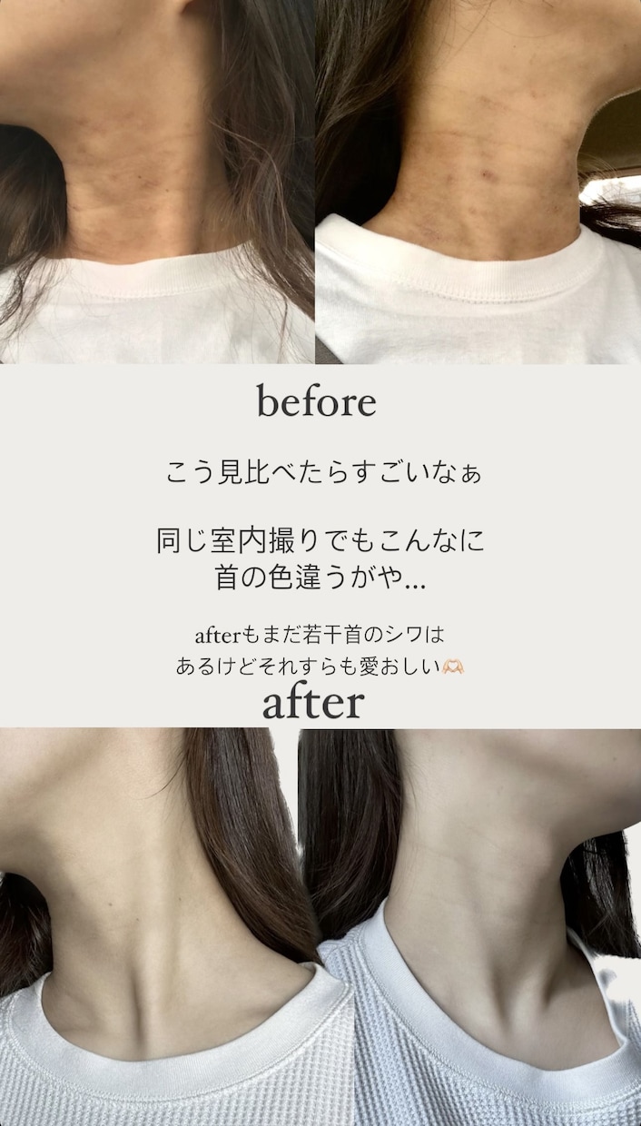 アトピーのお悩み聞きます 元15年アトピーだったアトピーカウンセラーがお話聞きます イメージ2