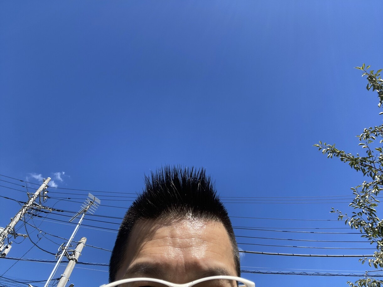 フケを忘れて自分らしさを引き出します フケさよなら、新しい人生の幕開け イメージ1