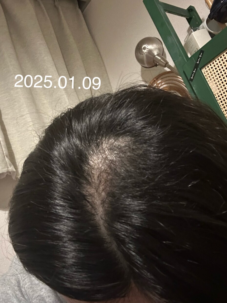 抜毛症専門！あなたの苦しみに寄り添います 私の経験談を詳しくお話します。 イメージ4