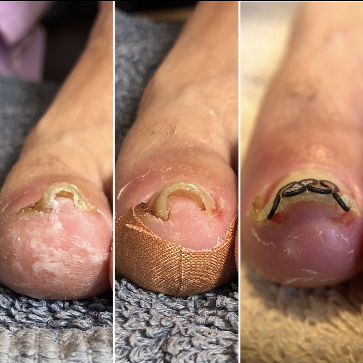 サロン向けです⭐️病的トラブルへの対策を伝授します お客様やあなたのリスクヘッジの為にレベルアップしませんか❓ イメージ4