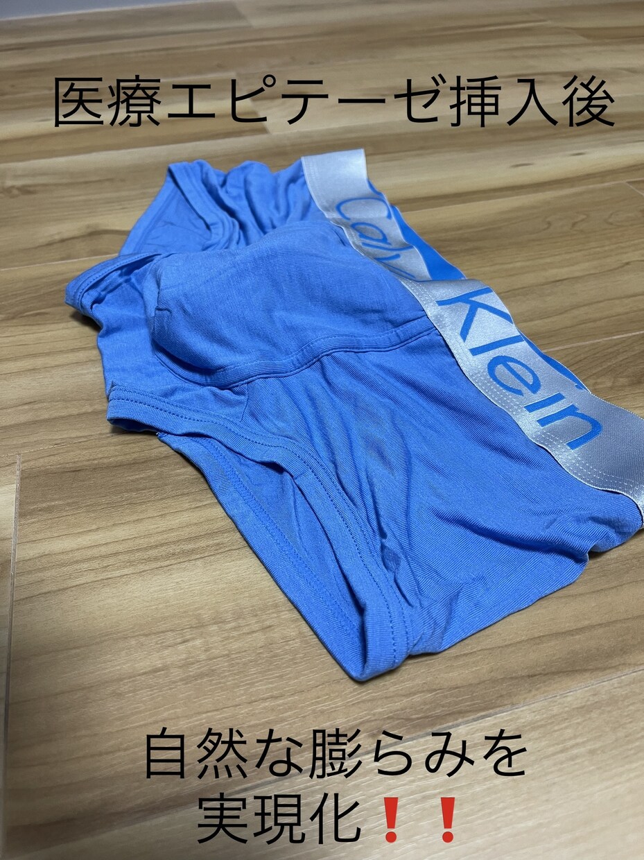 FTM専用の下着作製を指導させて頂きます これでもう更衣室も快適！周りの目を気にすることなく生活可能 イメージ2