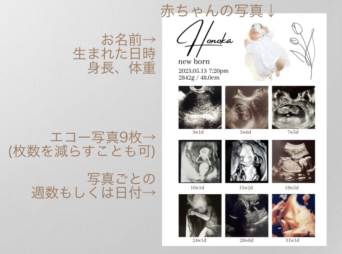 赤ちゃんの写真入りエコー写真ポスター作ります 大切な赤ちゃんの思い出をおしゃれに残しませんか？ イメージ6