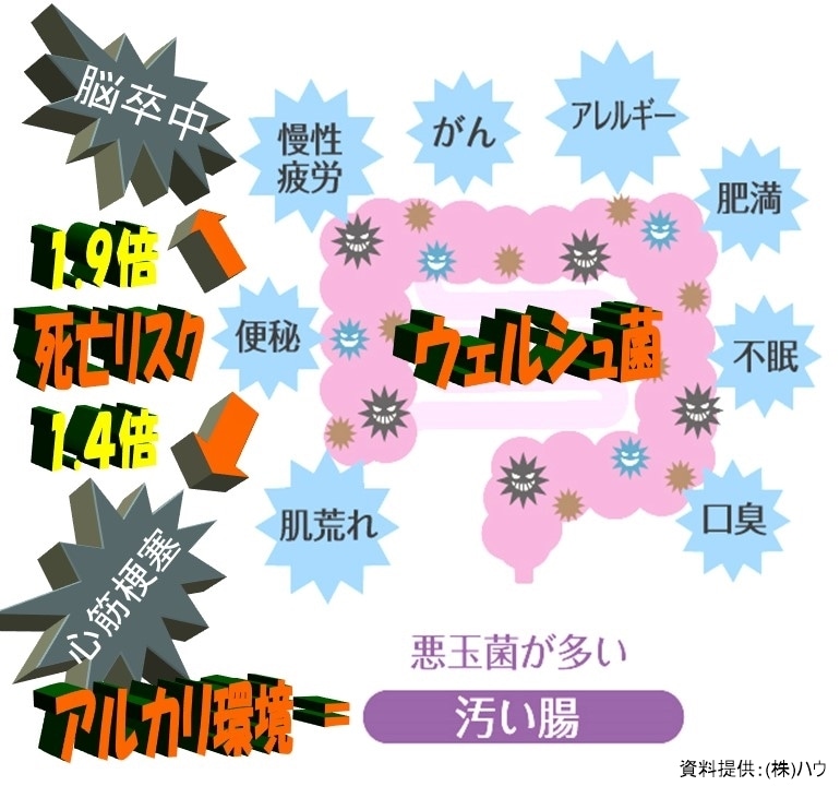 デトックスの一つ、コーヒーエネマの説明をします コーヒーエネマのノウハウをお教えします。 イメージ2