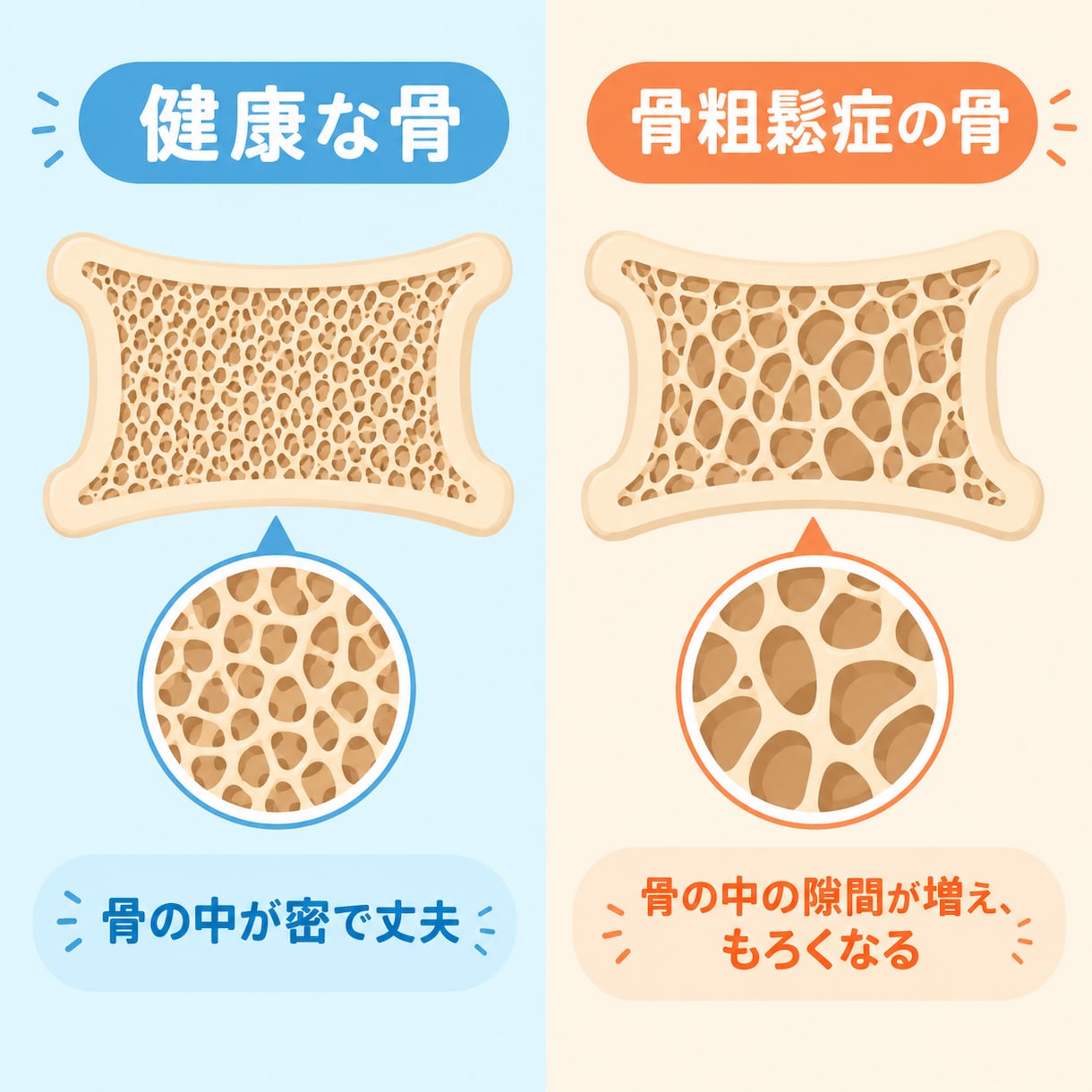 骨粗鬆症マネージャーが骨密度・健康相談にのります 検査結果の見方や生活習慣のアドバイス、病院で聞けなかった事も イメージ1