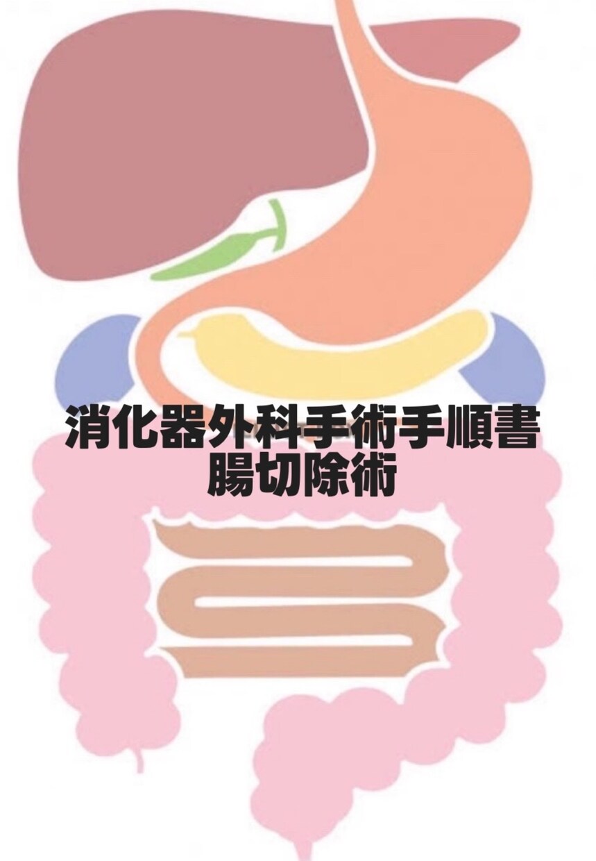 消化器外科手術手順書お渡しします 新人看護師/指導者/手術室看護師/腸切除 イメージ1