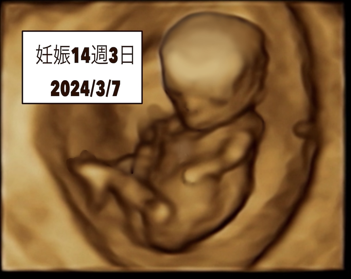 4Dエコーを自然に可愛く修正orイラスト化します 産婦人科専門医が4Dエコーをわかりやすく修正します。 イメージ1