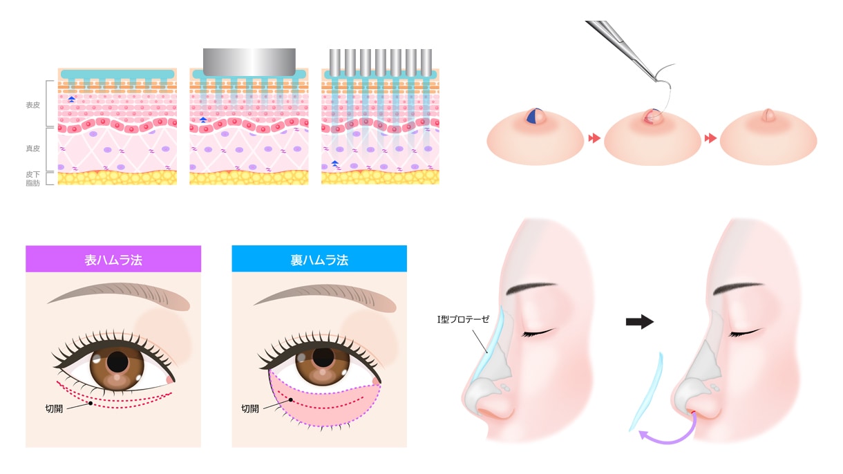 医療用イラスト作成いたします 医療用のイラストをお手軽なお値段で作成致します！ イメージ2