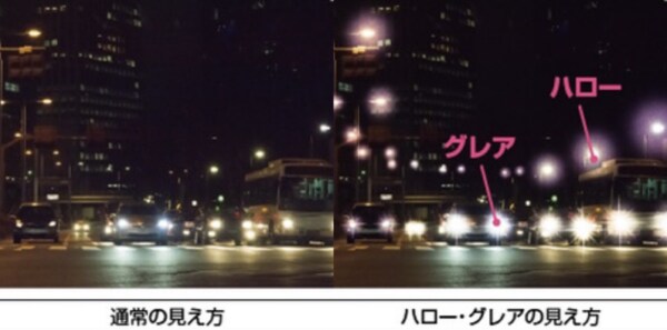 ICL経験者が手術のリアルな痛みや流れを教えます 新宿近視クリニック経験者と本音で話せるICLのリアルについて イメージ6