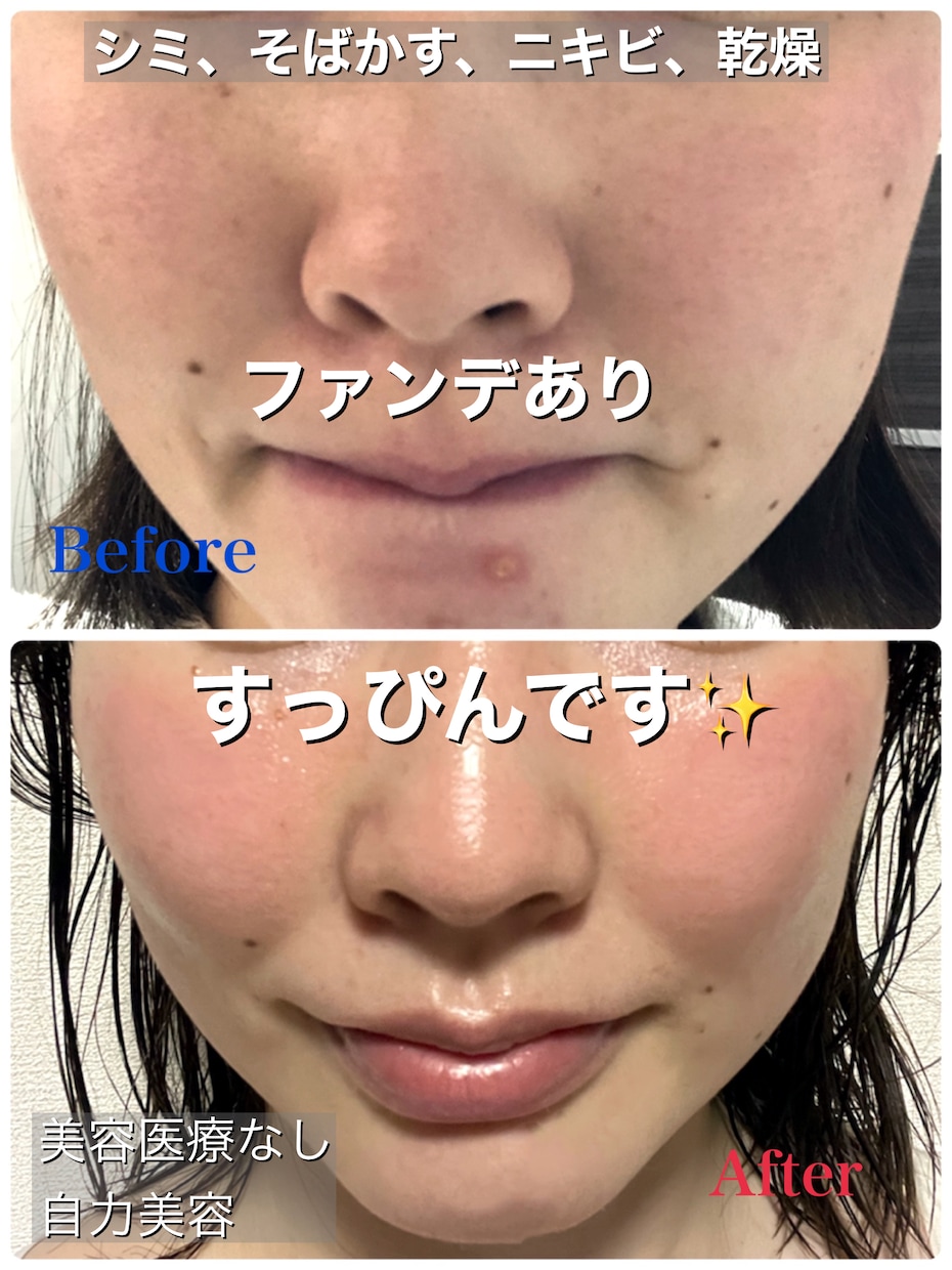 美肌になる方法◇すっぴんに自信がつく秘訣教えます 乾燥、ニキビ、しわたるみ、すべての肌トラブルにおすすめです☆ イメージ1