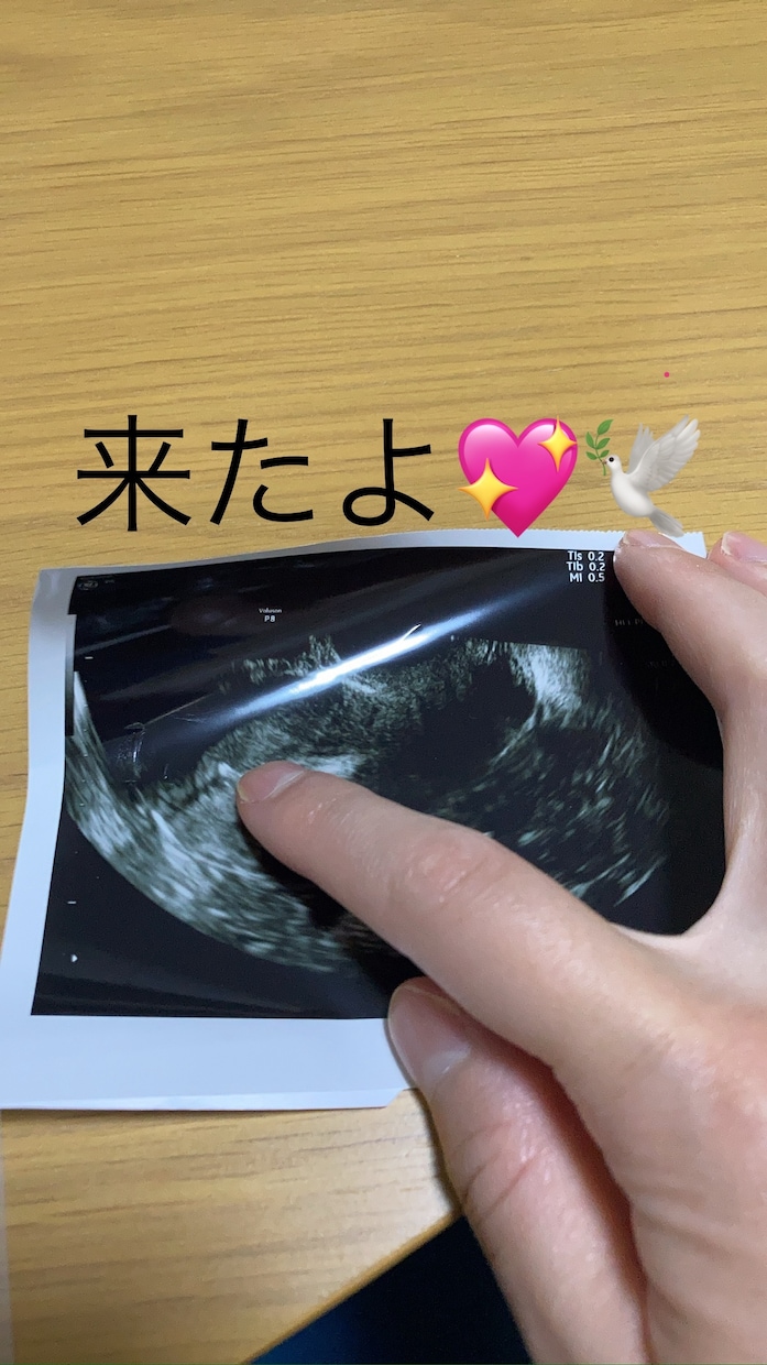 赤ちゃんが来る環境を伝授、子授子宝の引き寄せします 絶対に赤ちゃんが欲しい方、諦めたくない方、子授け最後の砦。 イメージ1