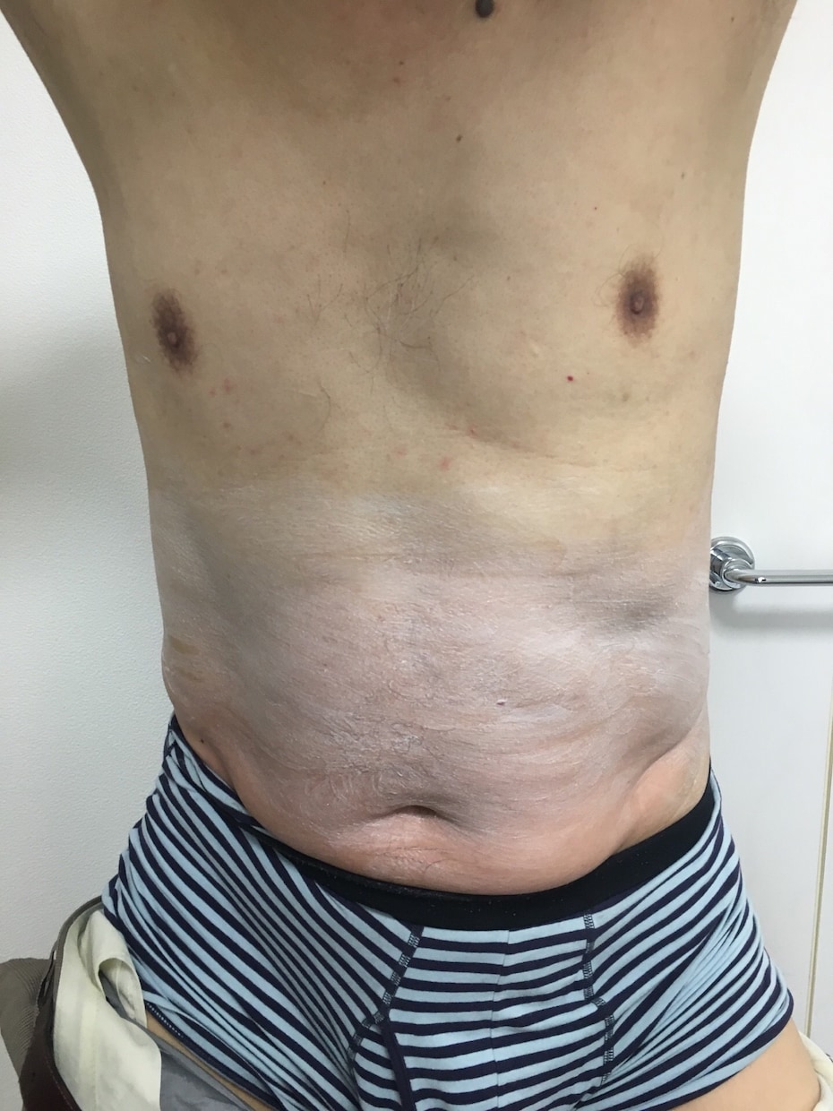 とても簡単に痩せる方法を教えます ダイエットめんどくさい方にオススメです！ イメージ2