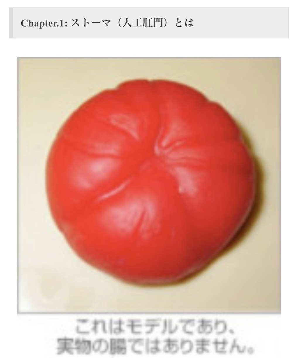 スキンケアや人工肛門の相談のります 看護師10年を過ぎた看護師がスキンケアの相談に乗ります。 イメージ1