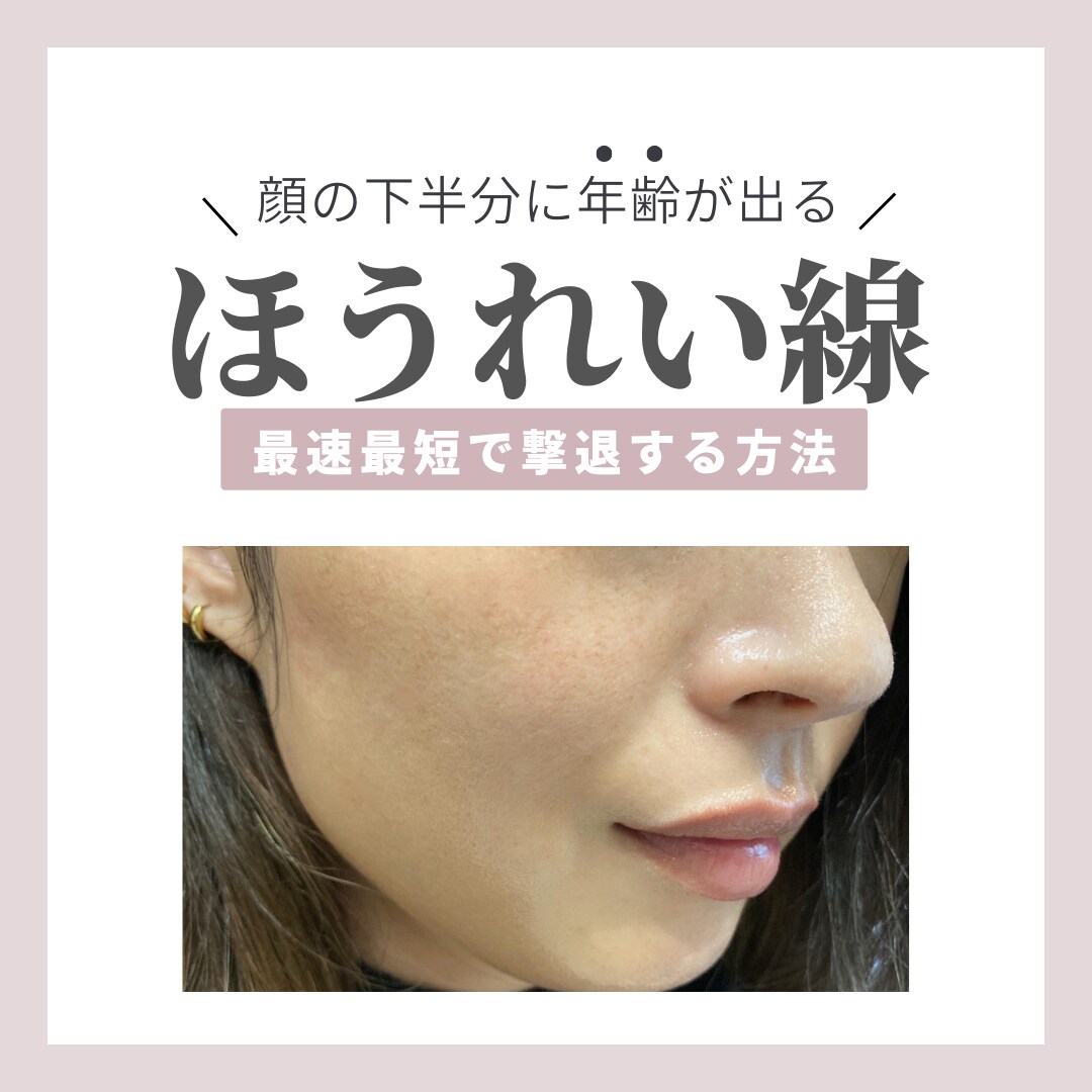 集客に繋がるInstagramの運用代行します プロチームだからこそ出来る丁寧なSNS運用(´▽`ʃ♡) イメージ8